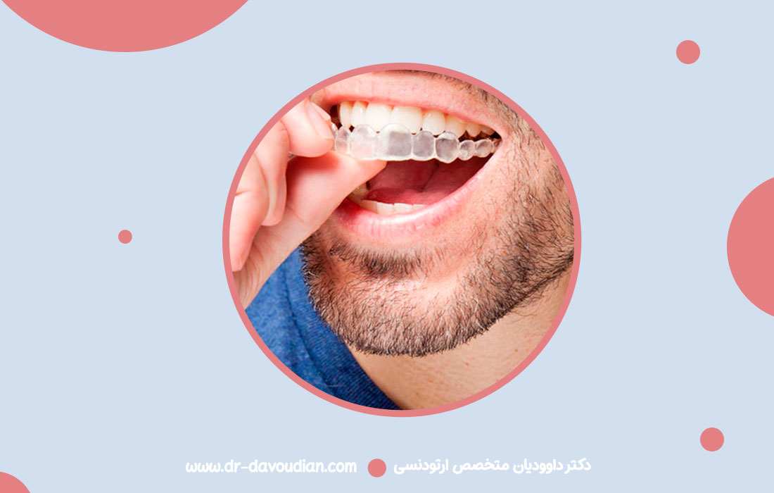 تفاوت متخصص ارتودنسی و دندانپزشک عمومی