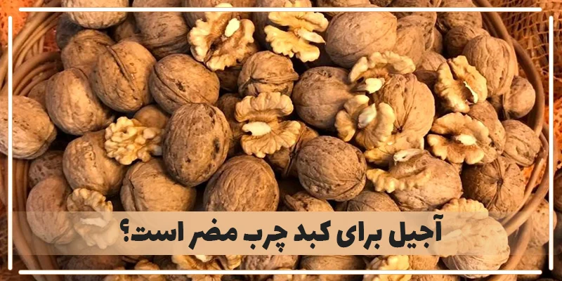کبد چرب کبد چرب