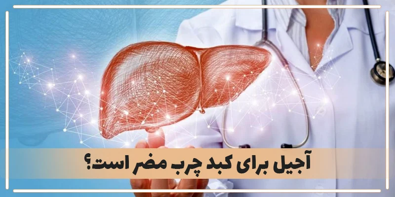 کبد چرب