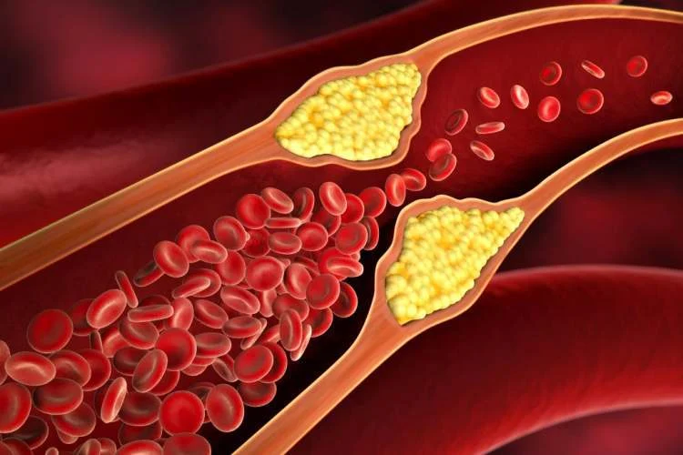 بیماری دکتر حکمت؛ متخصص قلب و عروق