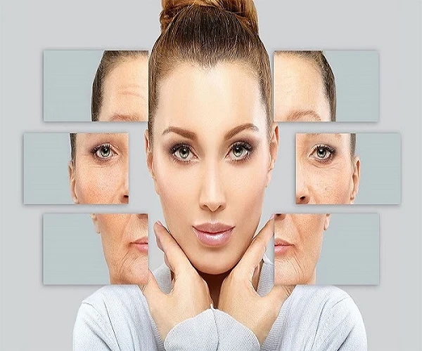 مزایای تزریق بوتاکس در اصفهان