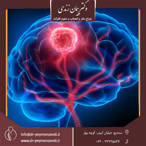  جراح مغز و اعصاب 