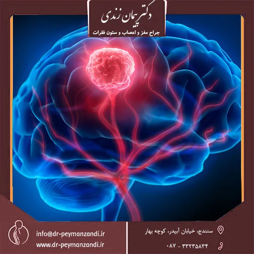 جراح مغز و اعصاب