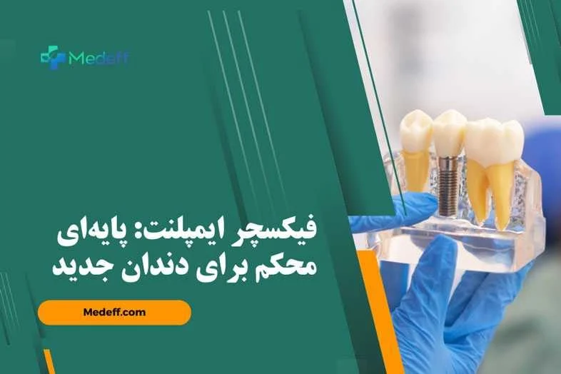 ایمپلنت | فناوری