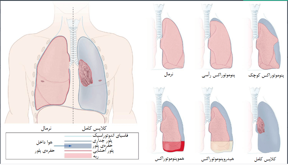 موتور