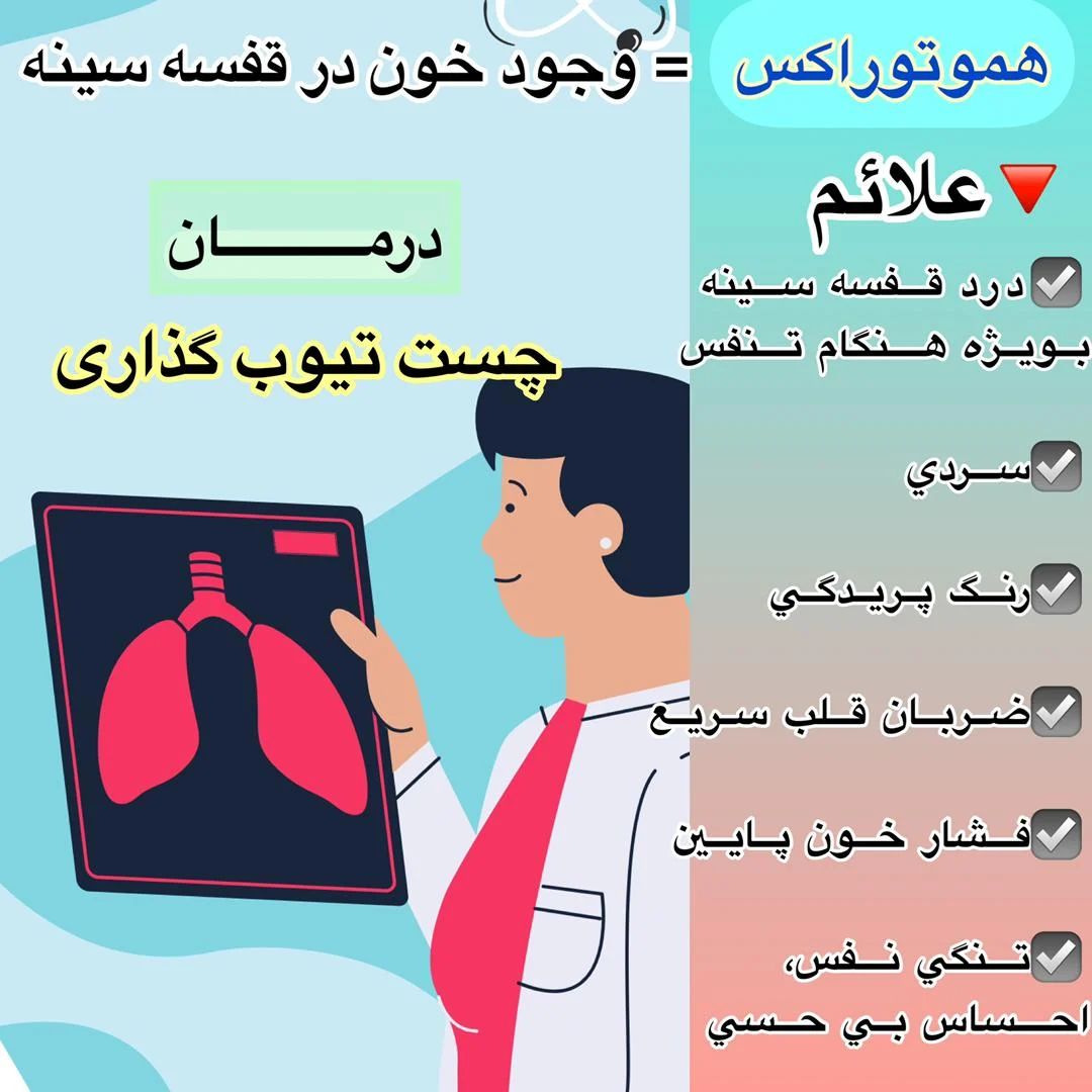 موتور موتور