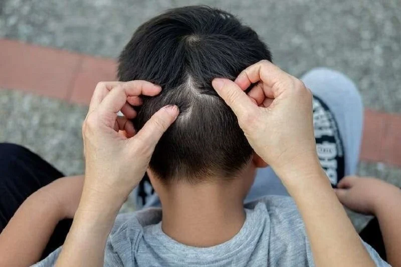 عمومی