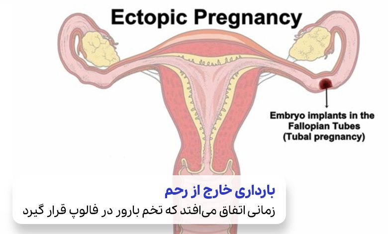 بارداری