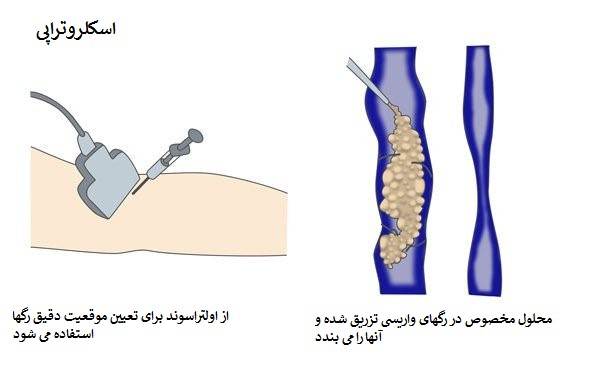 اپ