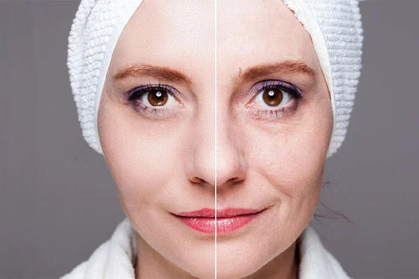  آیا کرم لیفت صورت برای هر نوع پوستی مناسب است؟