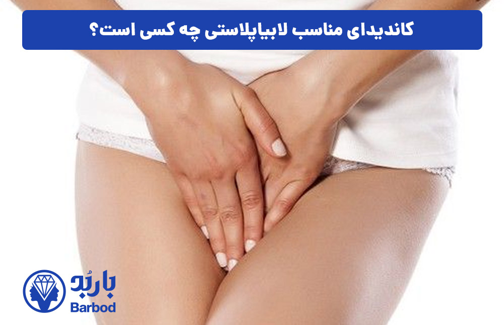 کاندیدای عمل لابیاپلاستی