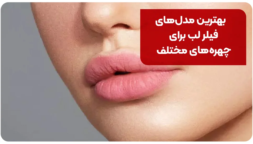 بهترین مدل های فیلر لب برای چهره های مختلف؛ راهنمای جامع انتخاب