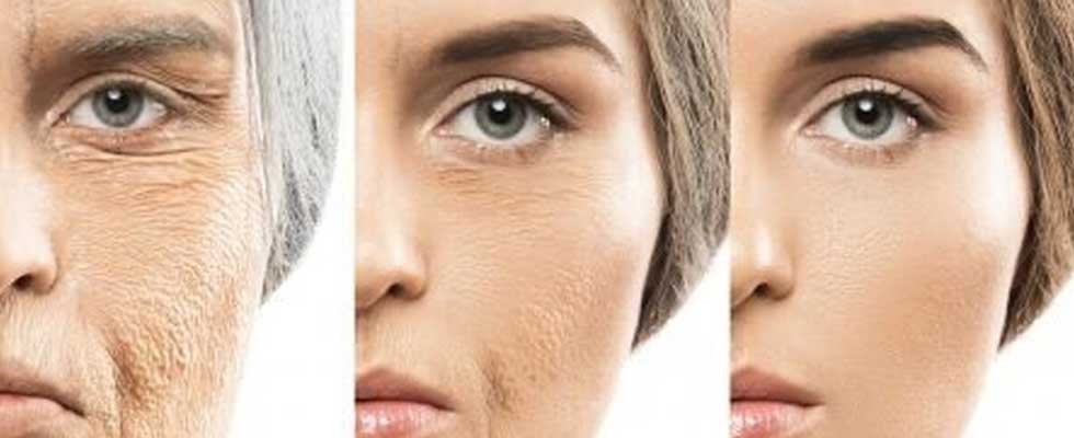 روند طبیعی پیری پوست و علائم آن