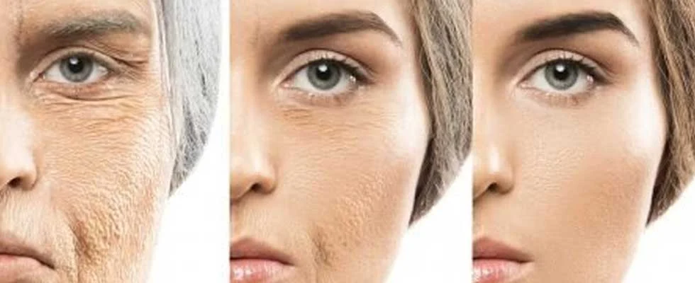 روند طبیعی پیری پوست و علائم آن